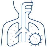 Bronchiectasis