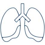 Pleural Effusion